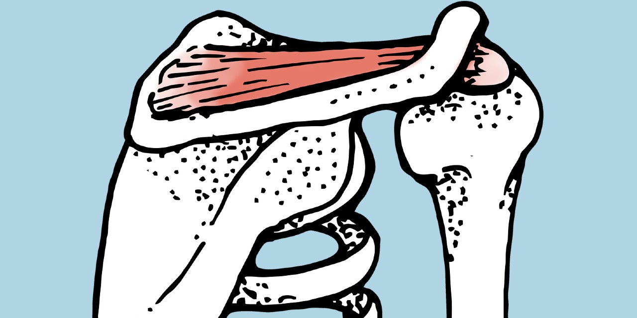 Hypermobility and Alexander Technique